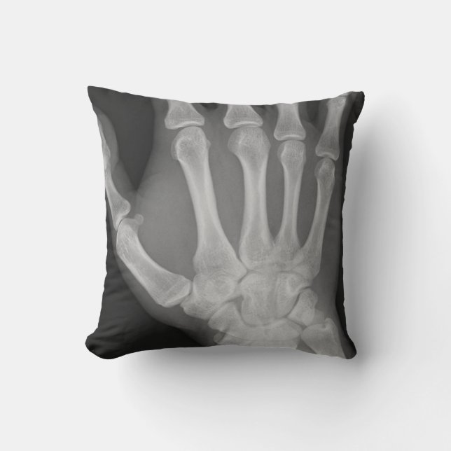 X-Ray Pillow (Front)