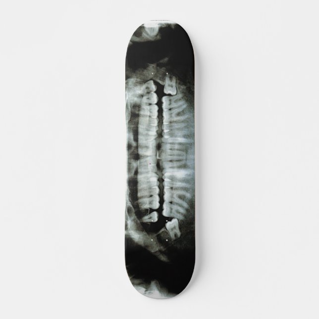 X-Ray Skateboard (Front)