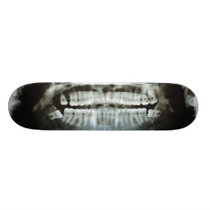 X-Ray Skateboard