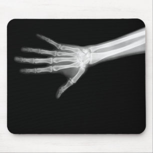 X-RAY SKELETON ARM B&W MOUSE MAT