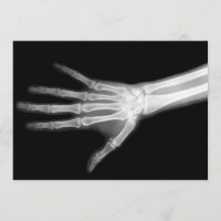 X-Ray Skeleton Arms Black & White