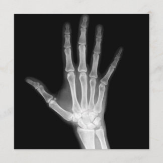 X-Ray Skeleton Arms Black & White Invitation