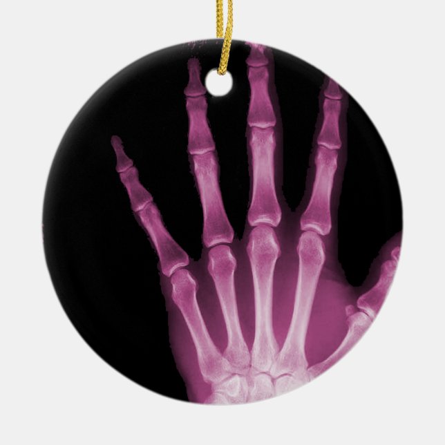 X-RAY SKELETON HAND FINGERS PINK CERAMIC TREE DECORATION (Front)
