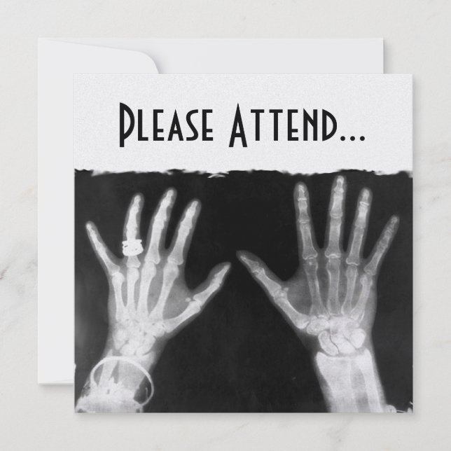 X-Ray Skeleton Hands & Jewellery - B&W (Front)