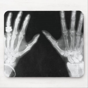 X-Ray Skeleton Hands & Jewellery - B&W Mouse Mat