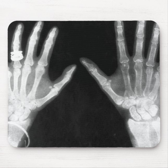 X-Ray Skeleton Hands & Jewellery - B&W Mouse Mat (Front)