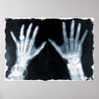 X-Ray Skeleton Hands & Jewellery - Blue Poster