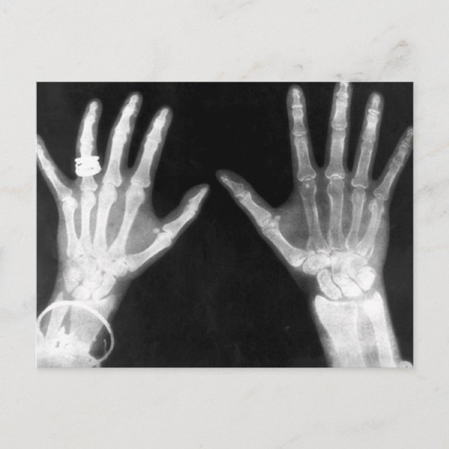 X-Ray Skeleton Hands & Jewelry - B&W Postcard (Front)