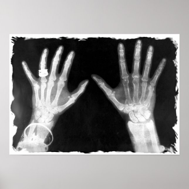 X-Ray Skeleton Hands & Jewelry - B&W Poster (Front)