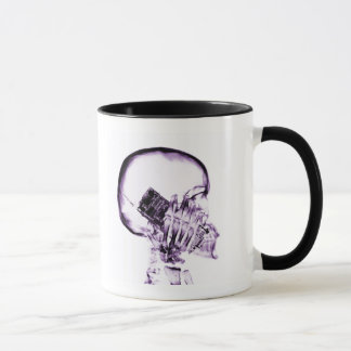 X-RAY SKELETON ON PHONE - PURPLE MUG