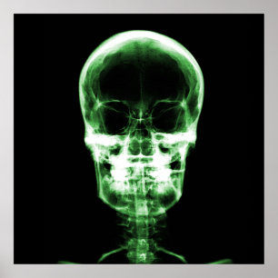 X-Ray Skeleton Skull - Green Poster