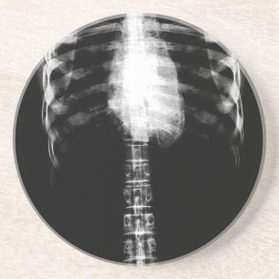 X-RAY SKELETON TORSO RIBS - B&W COASTER