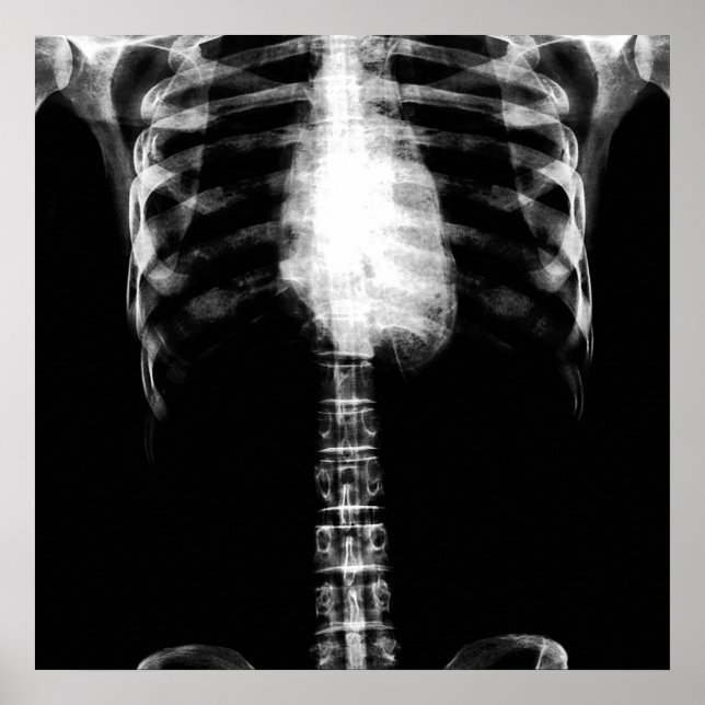 X-RAY SKELETON TORSO RIBS - B&W POSTER (Front)