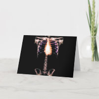 X-RAY SKELETON TORSO RIBS ORIGINAL
