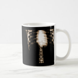 X-RAY SKELETON TORSO RIBS - SEPIA COFFEE MUG