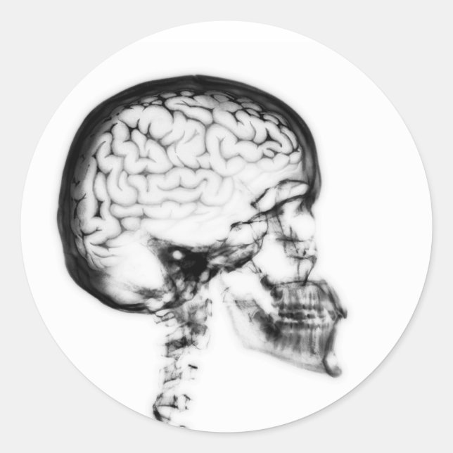 X-RAY SKULL BRAIN - BLACK & WHITE CLASSIC ROUND STICKER (Front)