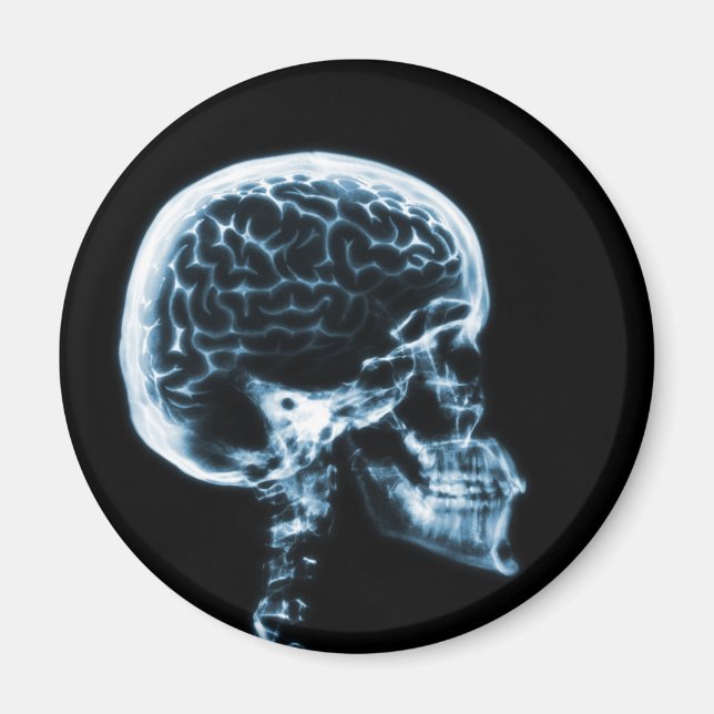 X-RAY SKULL BRAIN - BLUE MAGNET (Front)