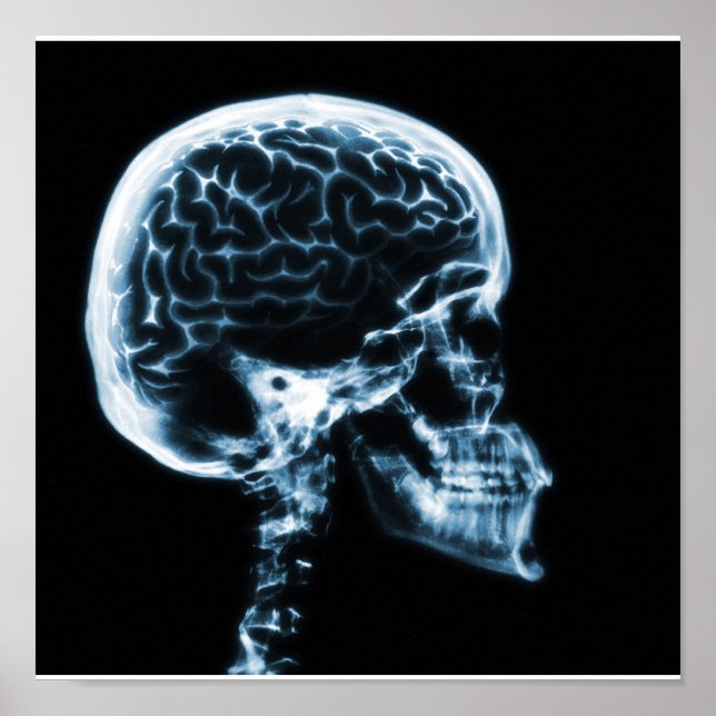 X-RAY SKULL BRAIN - BLUE POSTER (Front)