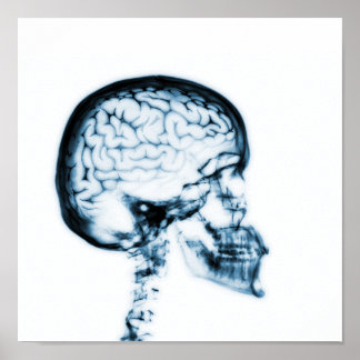 X-RAY SKULL BRAIN - BLUE POSTER