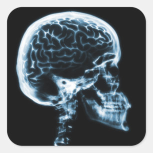 X-RAY SKULL BRAIN - BLUE SQUARE STICKER