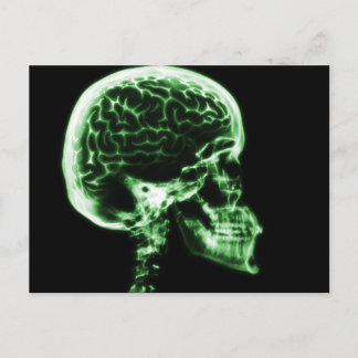 X-RAY SKULL BRAIN - GREEN POSTCARD