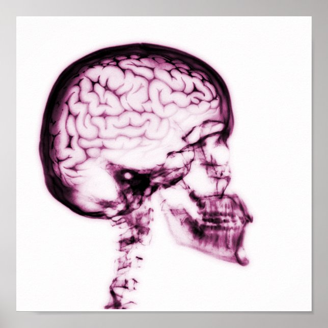 X-RAY SKULL BRAIN - PINK POSTER (Front)