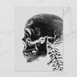 X-Ray Skull Postcard