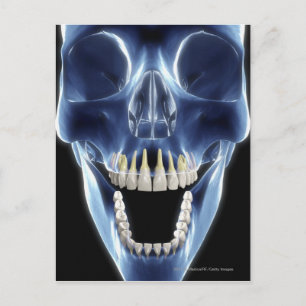 X-ray style look at human teeth postcard