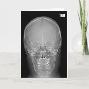 X-ray Ted Birthday Card