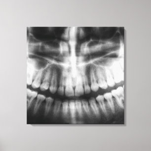 X-Ray Teeth Mouth Smile Black and White Canvas Print