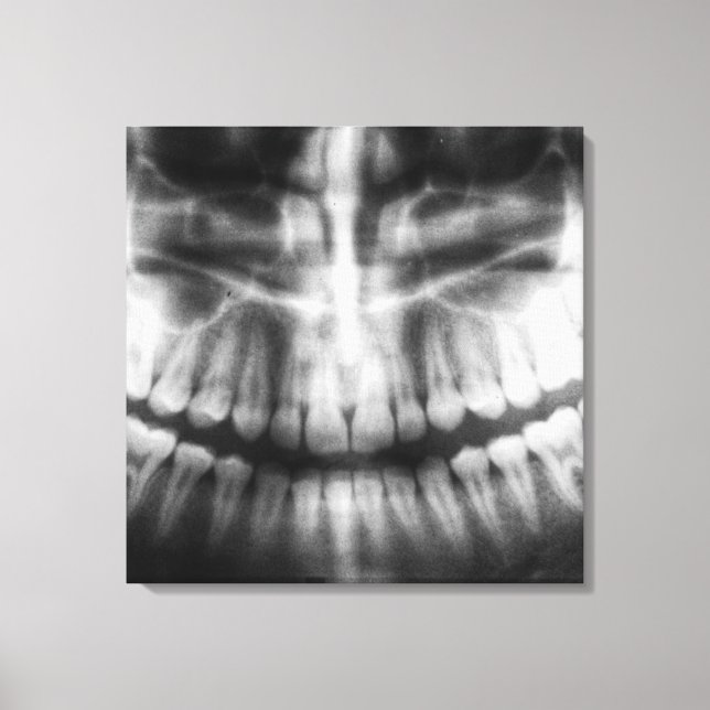 X-Ray Teeth Mouth Smile Black and White Canvas Print (Front)