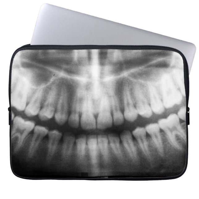 X-Ray Teeth Mouth Smile Black and White Laptop Sleeve (Front)