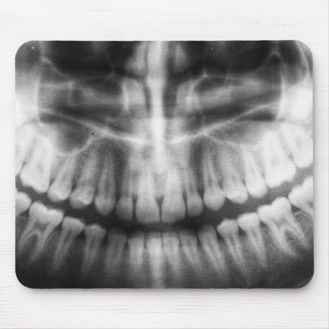 X-Ray Teeth Mouth Smile Black and White Mouse Mat (Front)