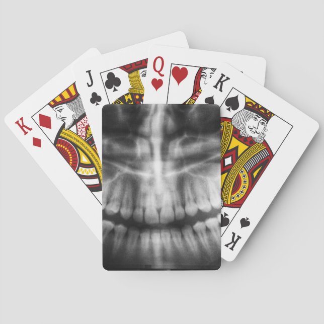 X-Ray Teeth Mouth Smile Black and White Playing Cards (Back)