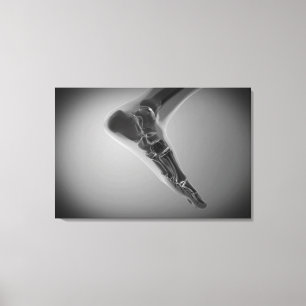 X-Ray View Of Human Foot 4 Canvas Print