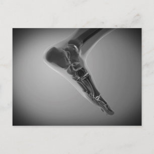 X-Ray View Of Human Foot 4 Postcard
