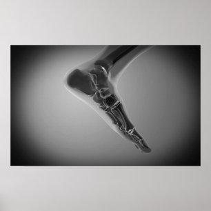 X-Ray View Of Human Foot 4 Poster