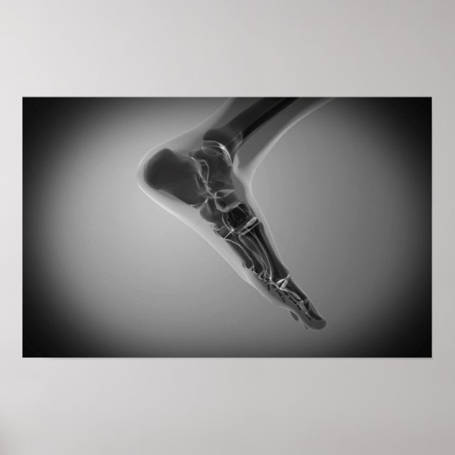 X-Ray View Of Human Foot 4 Poster (Front)