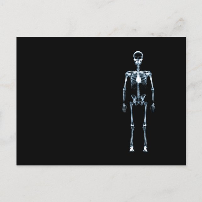 X-Ray Vision Blue Single Skeleton Postcard (Front)
