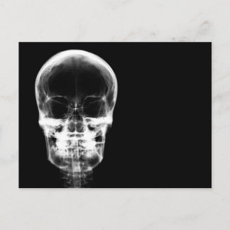 X-RAY VISION SKELETON SKULL - B&W POSTCARD