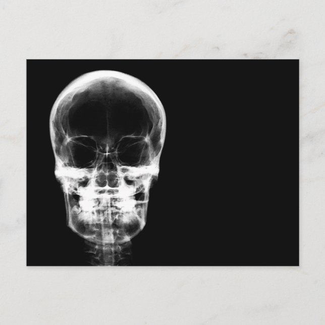 X-RAY VISION SKELETON SKULL - B&W POSTCARD (Front)