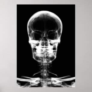 X-RAY VISION SKELETON SKULL - B&W POSTER