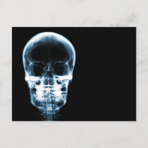 X-RAY VISION SKELETON SKULL - BLUE POSTCARD
