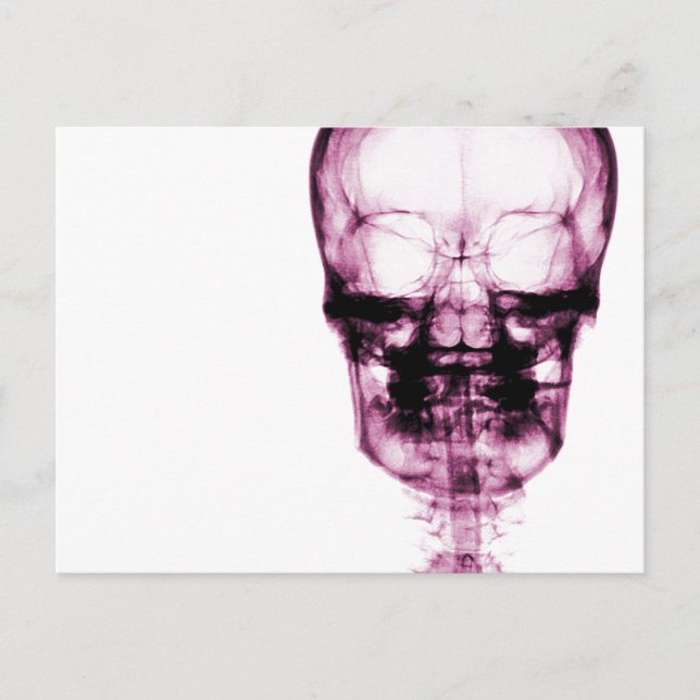 X-Ray Vision Skeleton Skull - Pink Postcard (Front)