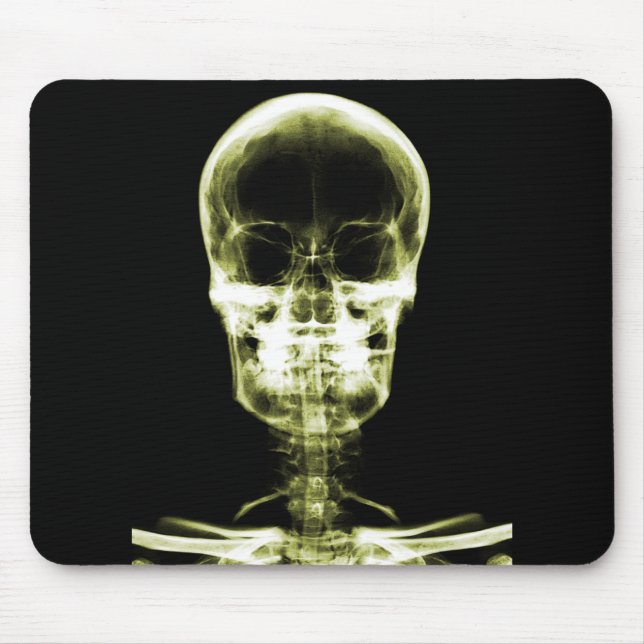 X-RAY VISION SKELETON SKULL - YELLOW MOUSE MAT (Front)