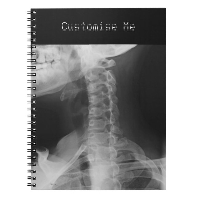 X-rayed 2 notebook (Front)