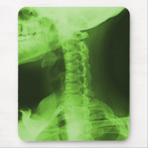 X-rayed 2 - Radioactive Green Mouse Mat