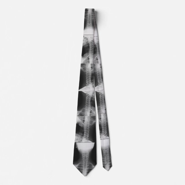 X-rayed 2 tie (Front)