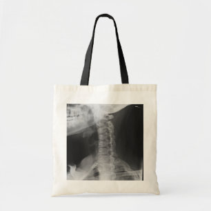 X-rayed 2 tote bag