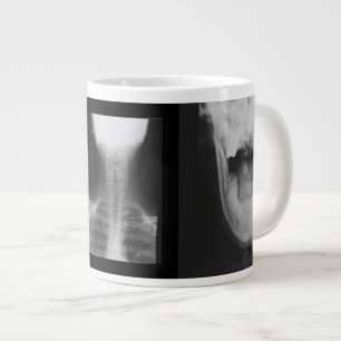 X-rayed 3 large coffee mug